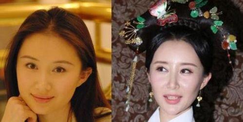 整容脸的明星,美丽背后的秘密与争议