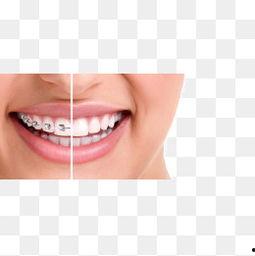 最美牙齿图片,最美牙齿图片背后的秘密